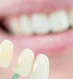 Zahnästhethik Lehrensteinsfeld - Zahnbleaching und Zahnaufhellung