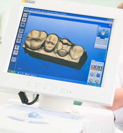 Zahnersatz Lehrensteinsfeld - Hochwertiger Zahnersatz, Füllungen und Kronen